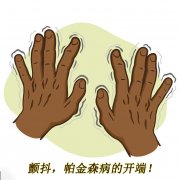 顫抖，帕金森病的開(kāi)端 帕金森的癥狀有哪些